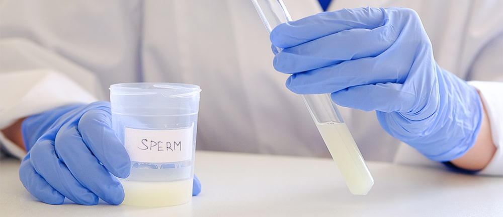 Semen sample being prepared for analysis