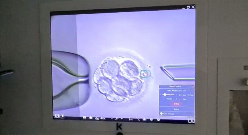 Embryo biopsy under laser control