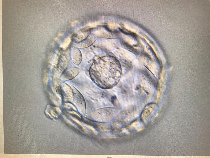 Embryo at the blastocyst stage