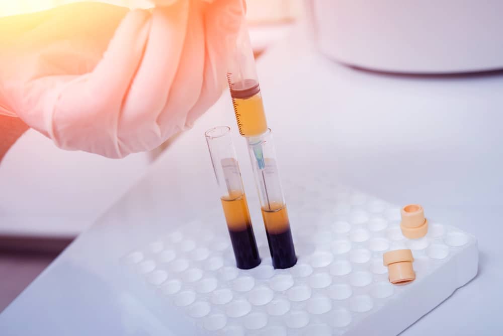 PRP separated in tubes after centrifugation